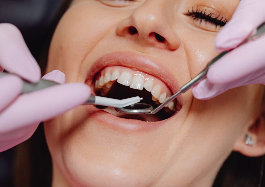 Odontologia general y cuidado de dientes